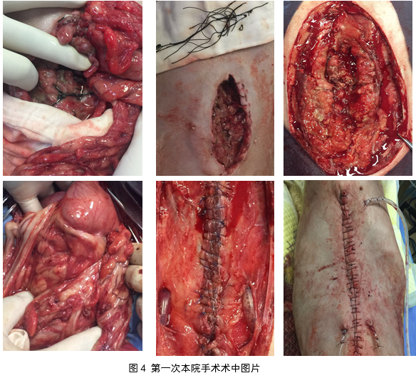 犬腹部手术术后伤口开裂的治疗